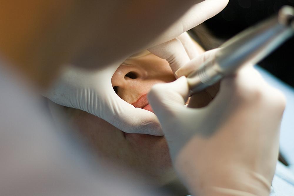 What is Skin Needling? Your Questions Explained.