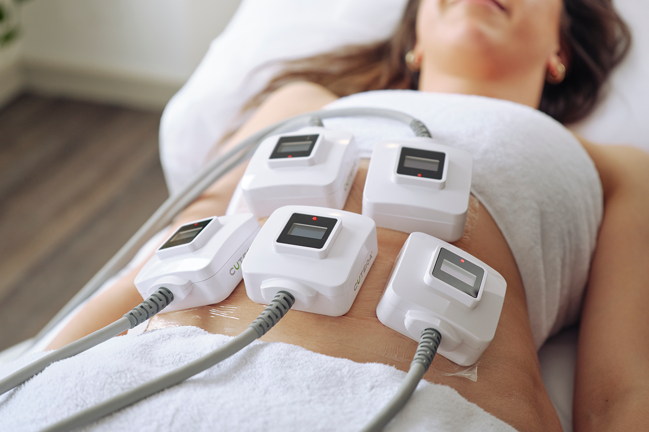 TruSculpt Benefits for Non-Surgical Body Contouring