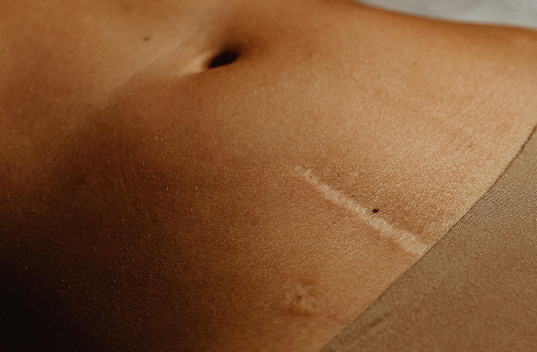 Body Treatments for Common Skin Concerns