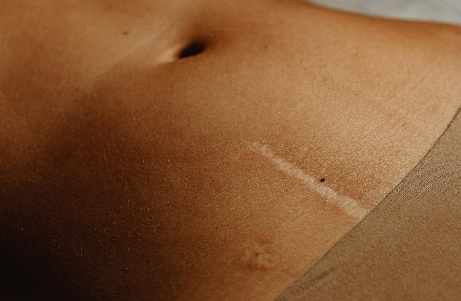 Body Treatments for Common Skin Concerns