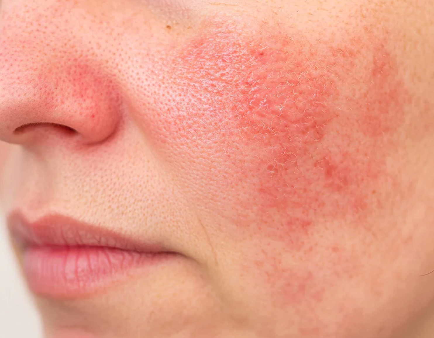 5 reasons why my skin is red
