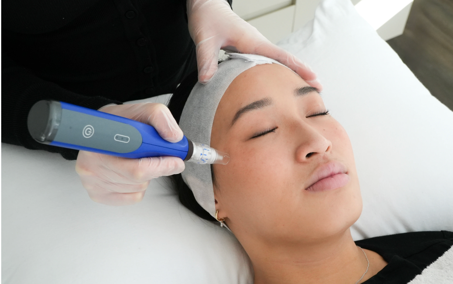 Is Skin Needling for me and should I be scared?