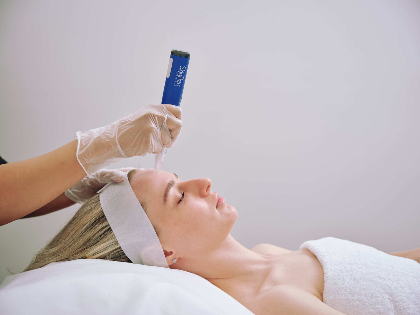 Microneedling vs. Laser Treatments: Which is Better for You