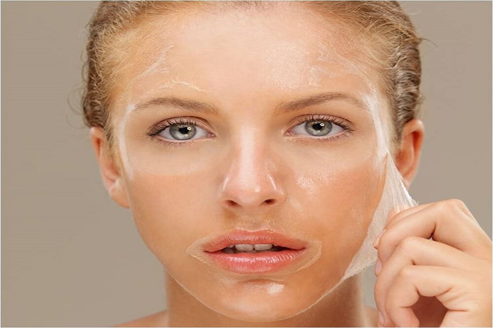 All You need To Know About Chemical Peels