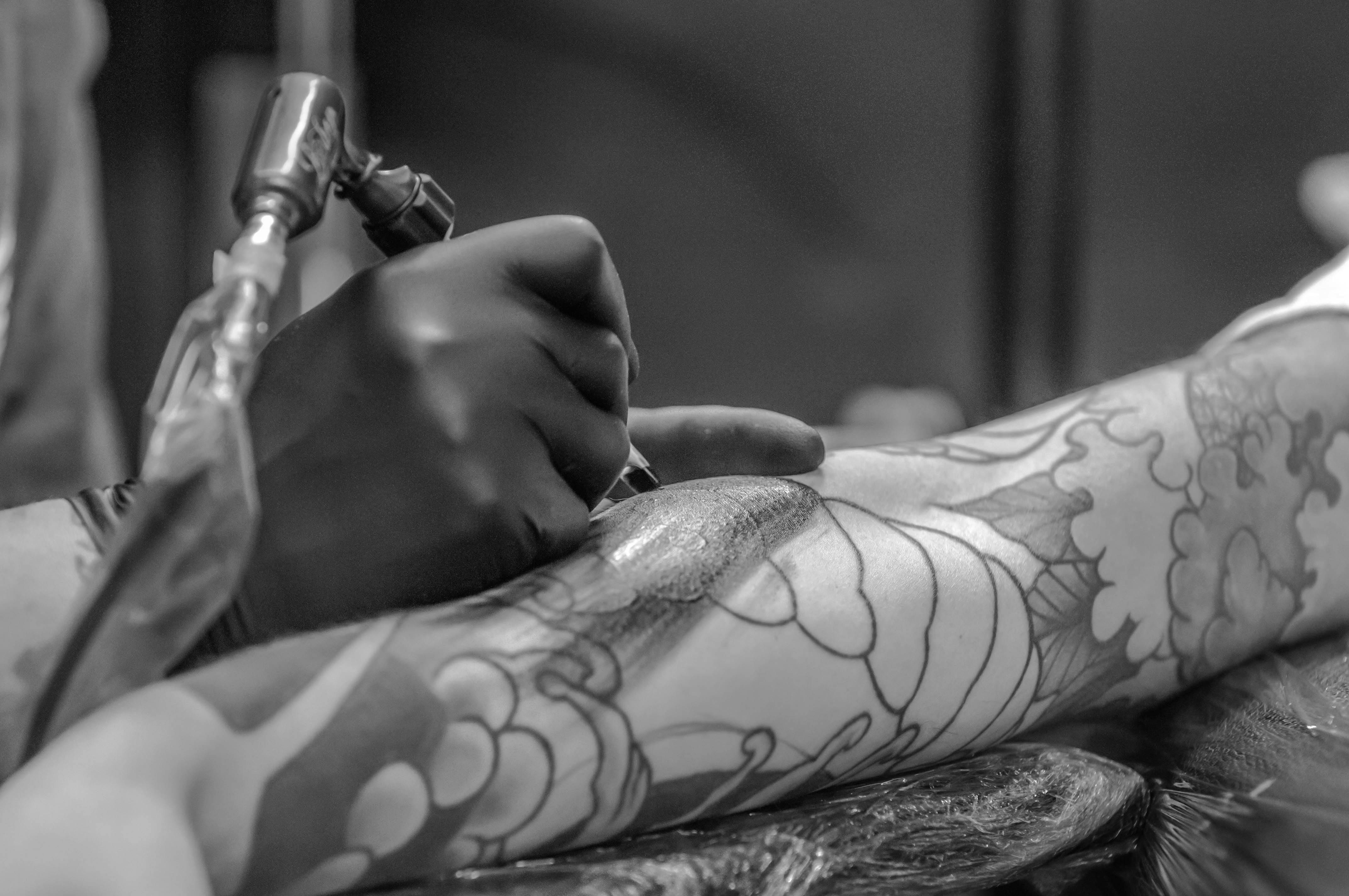 Laser tattoo removal: Does it really work?