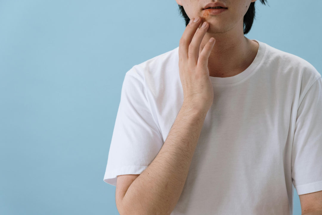Keratosis Pilaris: What You Need to Know