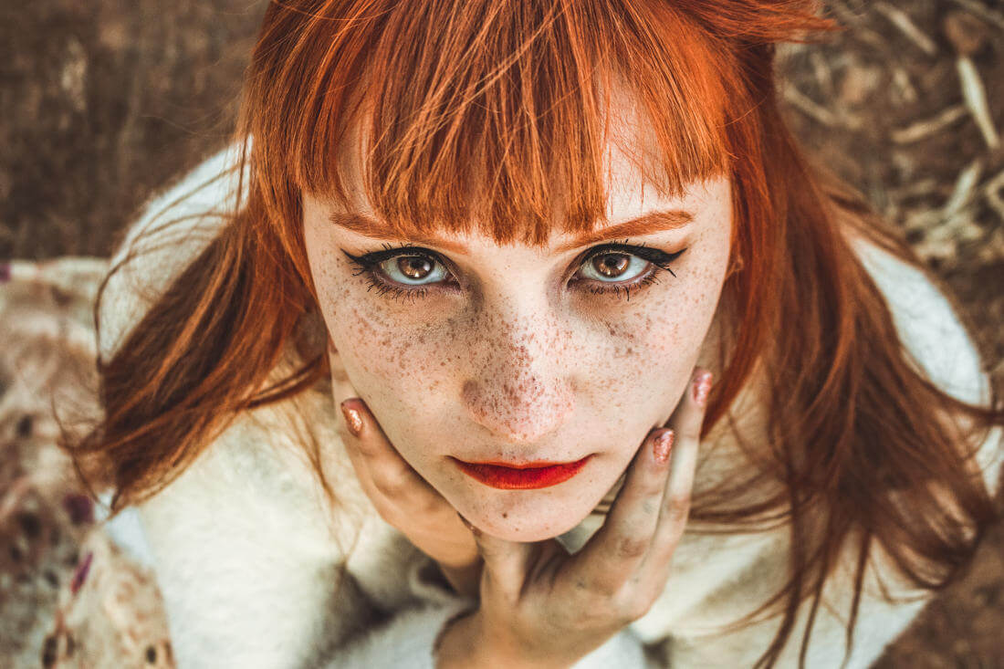 What Causes Freckles? The Complete Guide To Freckles