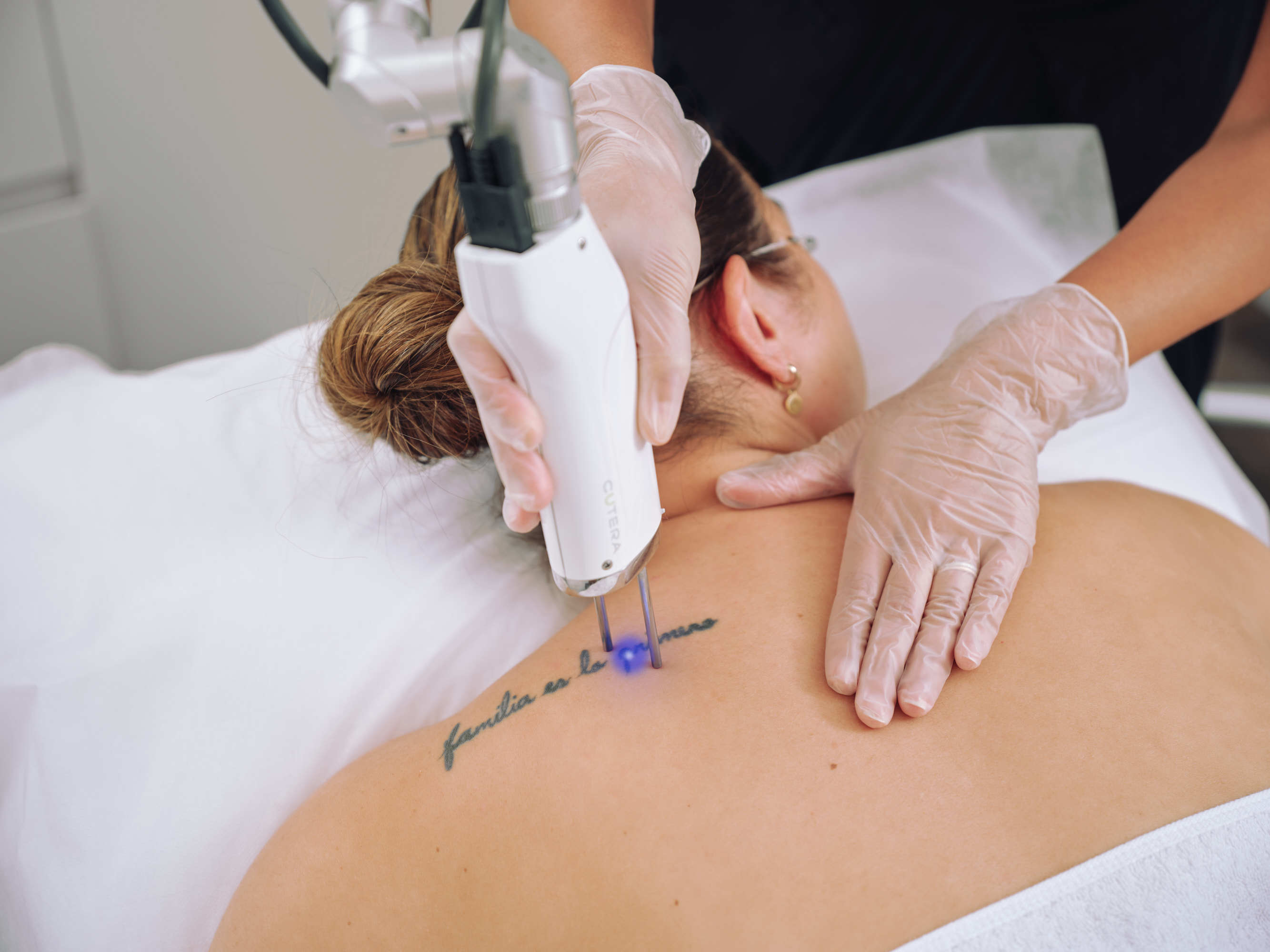 4 Things to know before getting Laser Tattoo Removal 💥 ⁣ ⁣ 1. It takes  time and MULTIPLE treatments. Your tattoo will turn white during treatment  (ink... | By Wilmington Dermatology CenterFacebook