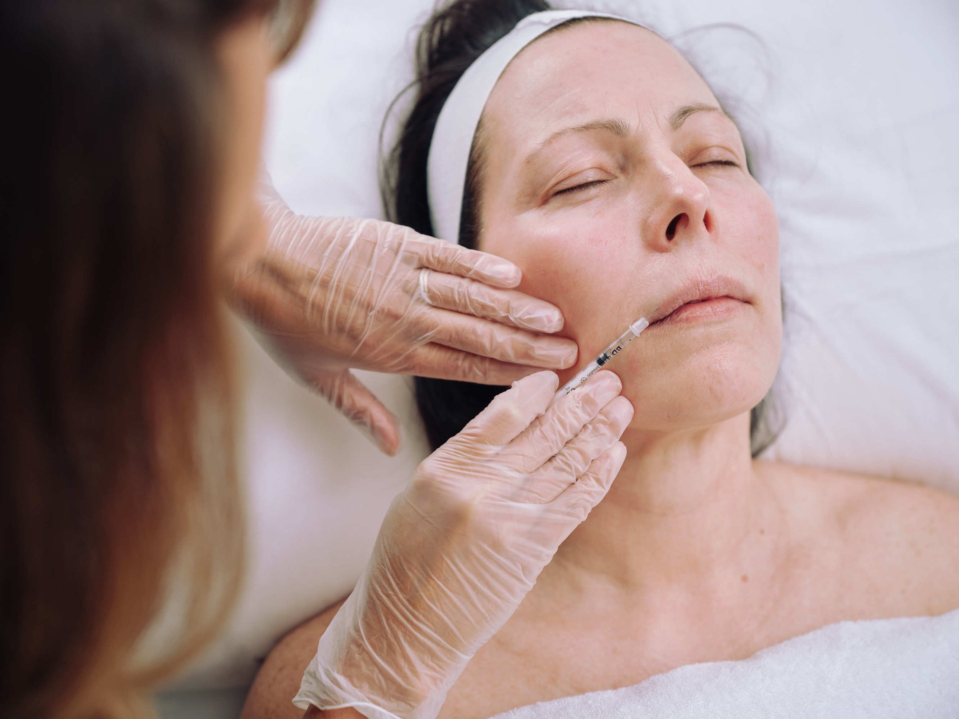 Lip Fillers & Injections in Melbourne & Ballarat Clinica Lase