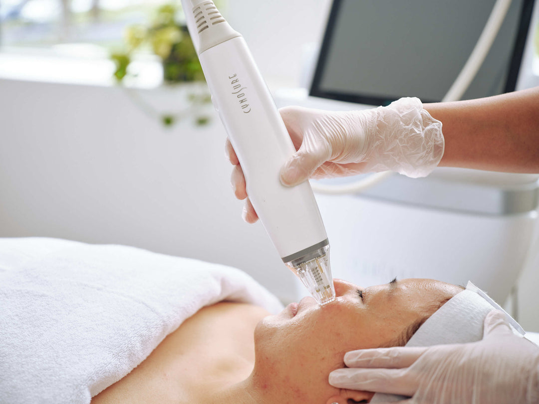 potenza skin treatment
